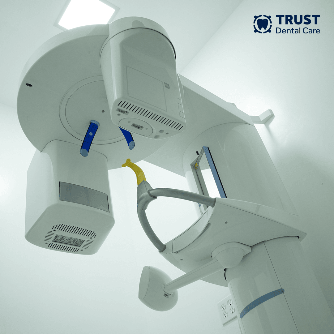 Sirona XG 3D scanner